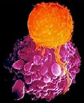 Dr. Max Gerson Resource Library Cancer The Forbidden Cures